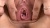 3345419 11 o